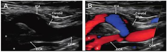 正確的電源穩(wěn)壓器能最大限度地減少直流電軌噪聲并提高超聲圖像的質(zhì)量 正確的電源穩(wěn)壓器能最大限度地減少直流電軌噪聲并提高超聲圖像的質(zhì)量